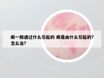 癣一般通过什么引起的 癣是由什么引起的?怎么治?