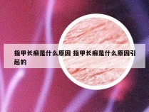 指甲长癣是什么原因 指甲长癣是什么原因引起的