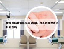 排毒养颜胶囊能治银屑病吗 排毒养颜胶囊可以去斑吗