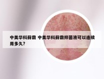 中美华科藓霸 中美华科藓霸抑菌液可以连续用多久?