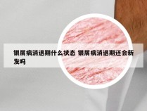 银屑病消退期什么状态 银屑病消退期还会新发吗