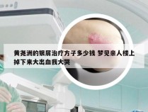 黄尧洲的银屑治疗方子多少钱 梦见亲人楼上掉下来大出血我大哭