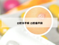 口腔太平癣 口腔扁平藓