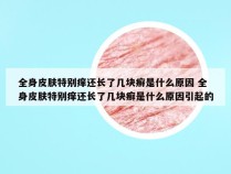 全身皮肤特别痒还长了几块癣是什么原因 全身皮肤特别痒还长了几块癣是什么原因引起的