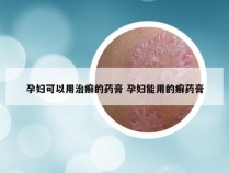 孕妇可以用治癣的药膏 孕妇能用的癣药膏