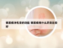 银屑癣净乳膏的功能 银屑癣用什么药膏比较好