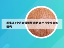 新生儿4个月会得银屑病吧 四个月宝宝会长藓吗