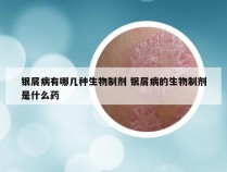 银屑病有哪几种生物制剂 银屑病的生物制剂是什么药