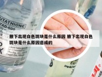 腋下出现白色斑块是什么原因 腋下出现白色斑块是什么原因造成的