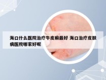 海口什么医院治疗牛皮癣最好 海口治疗皮肤病医院哪家好呢