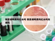 银屑病喝黑枸杞水吗 银屑病喝黑枸杞水吗有用吗