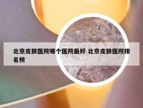 北京皮肤医院哪个医院最好 北京皮肤医院排名榜