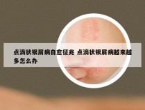 点滴状银屑病自愈征兆 点滴状银屑病越来越多怎么办