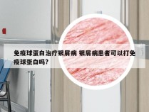 免疫球蛋白治疗银屑病 银屑病患者可以打免疫球蛋白吗?