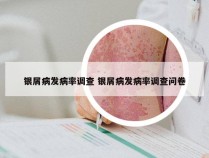 银屑病发病率调查 银屑病发病率调查问卷