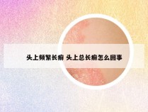 头上频繁长癣 头上总长癣怎么回事