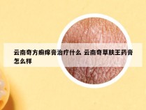 云南奇方癣痒膏治疗什么 云南奇草肤王药膏怎么样