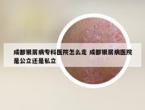 成都银屑病专科医院怎么走 成都银屑病医院是公立还是私立