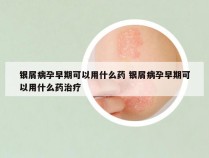 银屑病孕早期可以用什么药 银屑病孕早期可以用什么药治疗