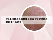 5岁小孩脸上长癣是什么原因 5岁宝宝脸上起癣用什么药膏