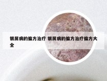 银屑病的偏方治疗 银屑病的偏方治疗偏方大全