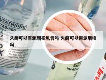 头癣可以擦派瑞松乳膏吗 头癣可以用派瑞松吗