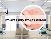 脖子上面有白斑图片 脖子上长白斑图片图库