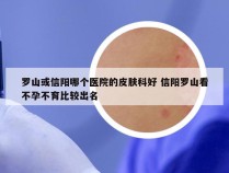 罗山或信阳哪个医院的皮肤科好 信阳罗山看不孕不育比较出名