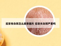 后背有白斑怎么回事图片 后背长白斑严重吗