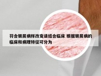 符合银屑病样改变请结合临床 根据银屑病的临床和病理特征可分为