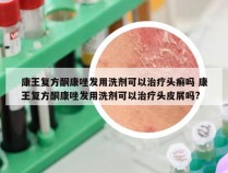 康王复方酮康唑发用洗剂可以治疗头癣吗 康王复方酮康唑发用洗剂可以治疗头皮屑吗?