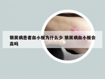 银屑病患者血小板为什么少 银屑病血小板会高吗