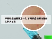 掌跖脓疱病要注意什么 掌跖脓疱病要注意什么饮食禁忌