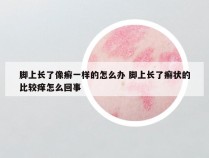 脚上长了像癣一样的怎么办 脚上长了癣状的比较痒怎么回事