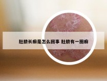 肚脐长癣是怎么回事 肚脐有一圈癣