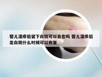 婴儿湿疹后留下白斑可以自愈吗 婴儿湿疹后出白斑什么时候可以恢复