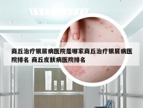 商丘治疗银屑病医院是哪家商丘治疗银屑病医院排名 商丘皮肤病医院排名