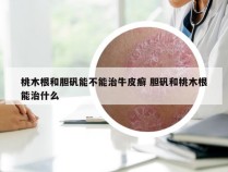 桃木根和胆矾能不能治牛皮癣 胆矾和桃木根能治什么