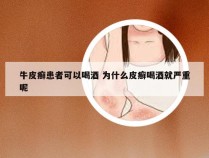 牛皮癣患者可以喝酒 为什么皮癣喝酒就严重呢