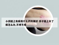 小孩腿上有癣用什么药效果好 孩子腿上长了癣怎么办,不疼不痒