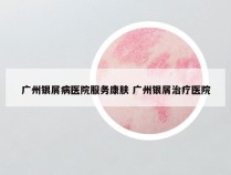 广州银屑病医院服务康肤 广州银屑治疗医院