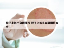 脖子上长小白斑图片 脖子上长小白斑图片大全