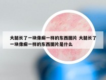 大腿长了一块像癣一样的东西图片 大腿长了一块像癣一样的东西图片是什么