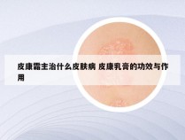 皮康霜主治什么皮肤病 皮康乳膏的功效与作用