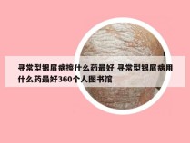 寻常型银屑病擦什么药最好 寻常型银屑病用什么药最好360个人图书馆