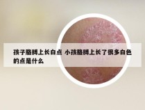 孩子胳膊上长白点 小孩胳膊上长了很多白色的点是什么