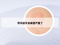 怀孕后牛皮癣更严重了