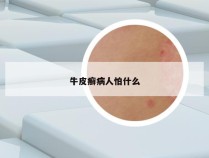 牛皮癣病人怕什么