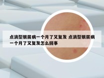 点滴型银屑病一个月了又复发 点滴型银屑病一个月了又复发怎么回事