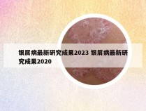 银屑病最新研究成果2023 银屑病最新研究成果2020